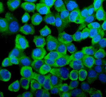 YB1 Antibody