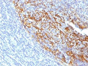 IHC staining of FFPE human tonsil with CD35 antibody (clone To5). HIER: boil tissue sections in pH 9