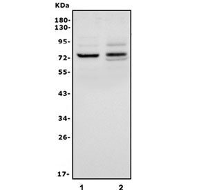 Western blot testing of human 1) HL60 and 2) A549 cell lysate with IL-18R Beta antibody. Predicted m