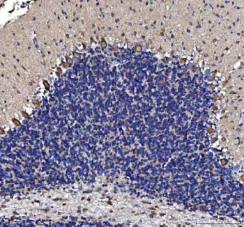 MTCL1 Antibody / Microtubule cross-linking factor 1 / KIAA0802