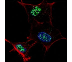 Fluorescent confocal image of SY5Y cells stained with KLF4 antibody at 1:100. Note the highly specif