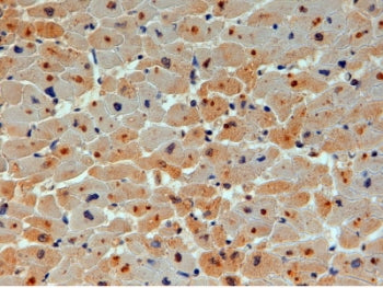 IHC testing of FFPE human heart with UBE2O antibody at 4ug/ml. HIER: steamed with pH6 citrate buffer