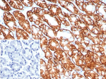 IHC staining of FFPE human stomach tissue with Claudin18.2 antibody (clone CLDN18.2/8141R). Inset: P