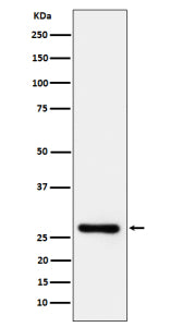 Western blot analysis of TRAIL R3 expression in human Jurkat cell lysate using TRAIL R3 antibody. Pr