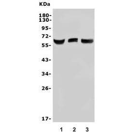 Arylsulfatase L Antibody / ARSL