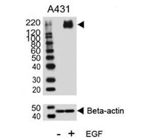 HER2 Antibody (ERBB2) (phospho-Y1140)