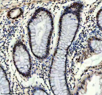 IHC staining of FFPE human colon tissue with Prospero homeobox protein 1 antibody, HRP-secondary and
