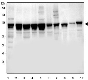 NUP98 Antibody