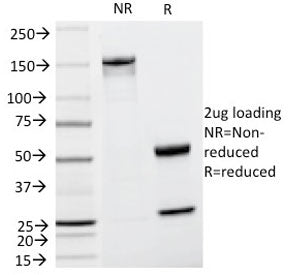 TRP1 / Tyrosinase-Related Protein-1 Antibody