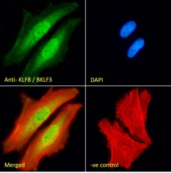 Immunofluorescent staining of fixed and permeabilized human HeLa cells with KLF8 antibody (green) at