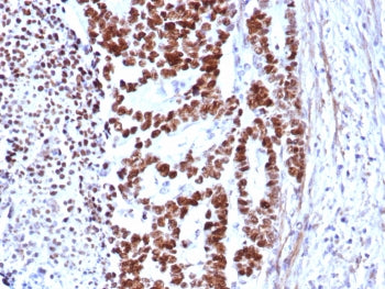 p53 Antibody / TP53