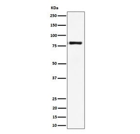 Western blot testing of human Raji cell lysate with LTK antibody. Predicted molecular weight: ~92 kD