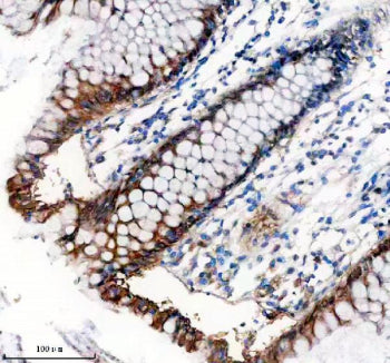 Immunohistochemical staining of TNS4 using anti-TNS4 antibody. TNS4 was detected in a paraffin-embed
