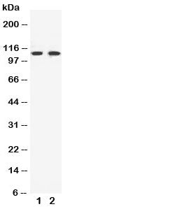 EphB3 Antibody Ephrin Receptor B3