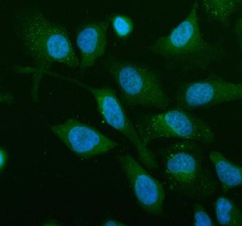 Immunofluorescent staining of Renin receptor/ATP6AP2 using anti-Renin receptor antibody (green). Ren