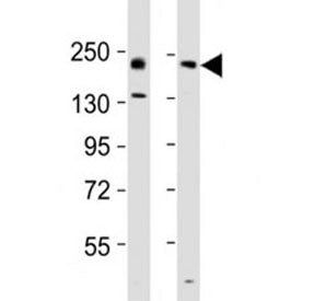Erbb2 Antibody