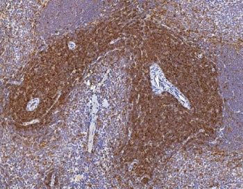 Cd2 Antibody