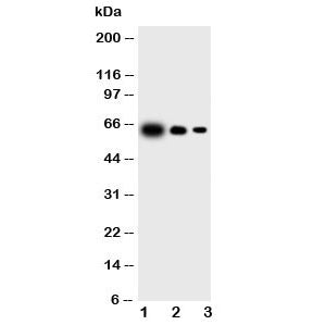Western blot testing of IL-23 antibody and Lane 1: recombinant mouse protein 10ng; 2: 5ng; 3: 2.5ng 