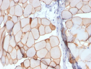 IHC staining of FFPE skeletal muscle with Dystrophin antibody (clone DMD/3241). HIER: boil tissue se