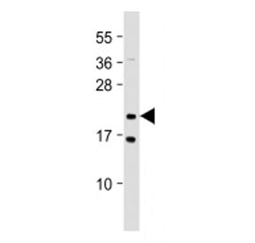 Western blot testing of NRAS antibody at 1:2000 + rat PC12 cell lysate. Predicted molecular weight ~