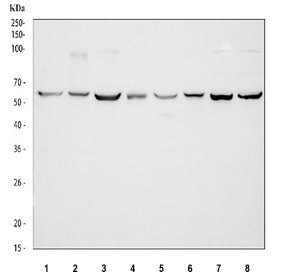TCP1 beta Antibody / CCT2