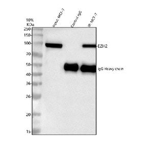 Immunoprecipitation of EZH2 protein from 500ug of human MCF7 whole cell lysate with 2ug of EZH2 anti