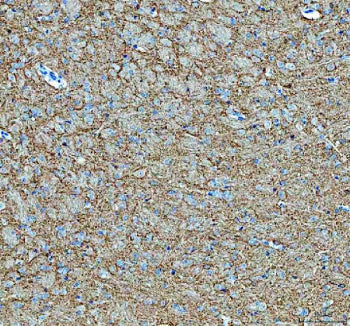 Immunohistochemical staining of SNCB using anti-SNCB antibody. SNCB was detected in a paraffin-embed
