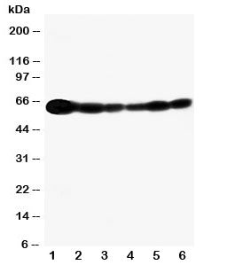 Western blot testing of SHC antibody and Lane 1: rat brain; and human samples 2: A549; 3: A431; 4: 2
