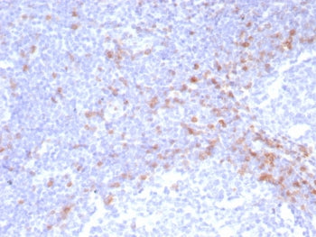 IHC staining of FFPE human tonsil tissue with recombinant IgD Heavy Chain antibody (clone IGHD/8228R