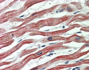 IHC staining of FFPE human heart with EPM2AIP1 antibody at 5ug/ml. HIER: steamed with pH6 citrate bu