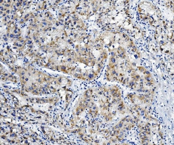 ALDH6A1 Antibody