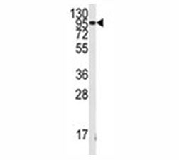Western blot analysis of FGFR antibody and K562 lysate. Predicted molecular weight: 75-160 kDa depen