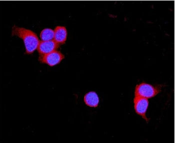 TNXB Antibody