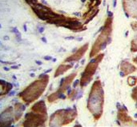 IHC testing of FFPE human skeletal muscle tissue with Filamin A antibody. HIER: steam section in pH6