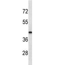 LHX2 antibody western blot analysis in MDA-MB435 lysate. Predicted molecular weight ~44kDa.