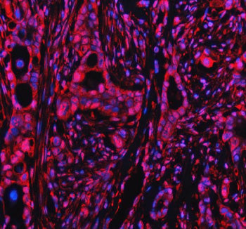 Immunofluorescent staining of PPP1R8 using anti-PPP1R8 antibody (red). PPP1R8 was detected in a para