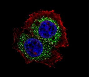 Fluorescent confocal image of MCF-7 cell stained with Estrogen Receptor antibody at 1:25. ER (isofor