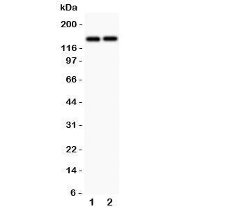 Western blot testing of Collagen III antibody and human cell lysates 1) MCF-4 and 2) COLO320. Predic