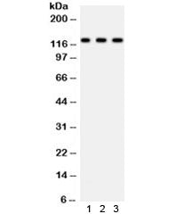 Western blot testing of 1) mouse heart, 2) human 22RV1 and 3) human HeLa cell lysate with PLD1 antib