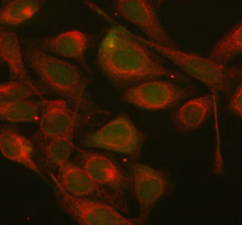 Immunofluorescent staining of AXIN1 using anti-AXIN1 antibody (green) and anti-Beta Tubulin antibody
