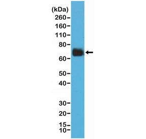Western blot testing of human HeLa cell lysate with recombinant Cyclooxygenase 2 antibody at 1:2000 