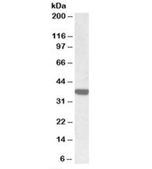 Western blot testing of human duodenum lysate with Calponin 3 antibody at 0.3ug/ml. Predicted molecu
