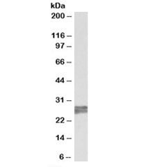 Western blot testing of human heart lysate with TNNI3 antibody at 0.2ug/ml. Predicted molecular weig
