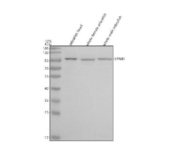 Western blot analysis of Importin Beta/Kpnb1 protein using Zebrafish Kpnb1 antibody and 1) zebrafish
