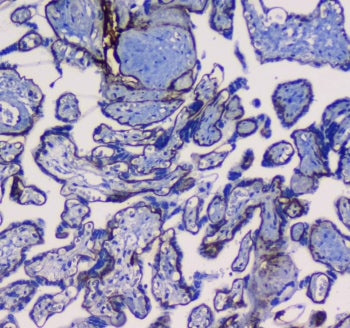 Integrin alpha 5 Antibody / ITGA5