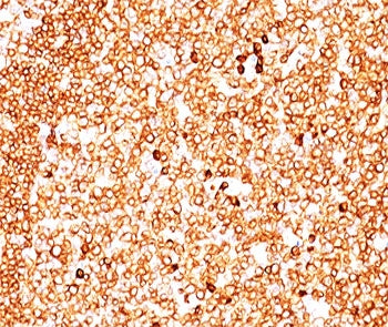 IHC testing of FFPE human tonsil (10X) stained with CD79a antibody cocktail (clone JCB117 + HM47/A9)