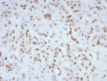 IHC staining of FFPE human colon tissue with MLH1 (MLH1/8855R). HIER: boil tissue sections in pH 9 1