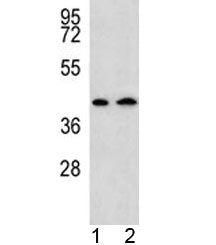 AADAT antibody western blot analysis in human 1) HepG2, and 2) Y79 lysate. Predicted molecular weigh