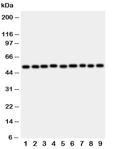 Western blot testing of E2F2 antibody and rat samples 1: lung; 2: heart; 3: brain; 4: kidney; and hu