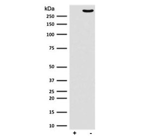Western blot testing of lambda phosphatase treated and untreated human MCF7 cell lysate with phospho